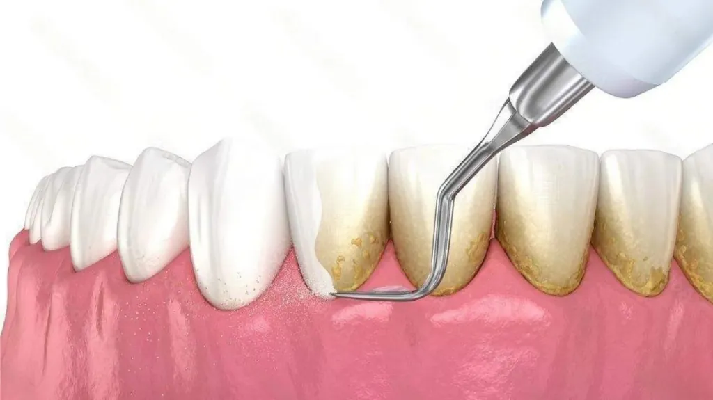 Foods That Help Protect Your Enamel